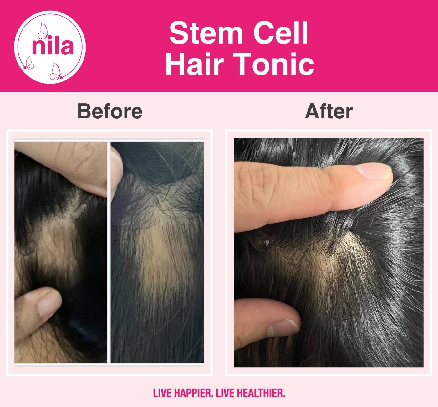 Stem-Cell-Hair-Tonic-5.jpg